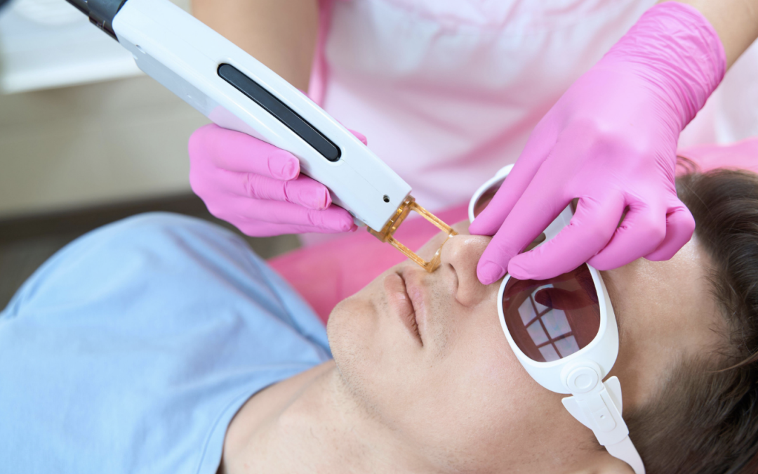 First Photofacial Near Olney MD